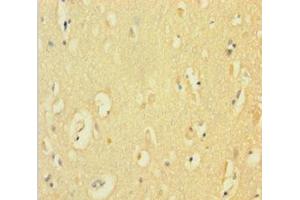 Immunohistochemistry of paraffin-embedded human brain tissue using ABIN7149094 at dilution of 1:100 (CYBB Antikörper  (AA 283-570))