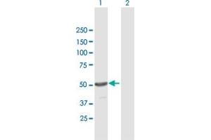 Western Blot analysis of TINF2 expression in transfected 293T cell line by TINF2 MaxPab polyclonal antibody.