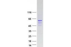 Validation with Western Blot (SAMD7 Protein (Myc-DYKDDDDK Tag))