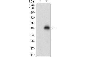 Western blot analysis using NPC1 mAb against HEK293 (1) and NPC1 (AA: 34-174)-hIgGFc transfected HEK293 (2) cell lysate. (NPC1 Antikörper  (AA 34-174))