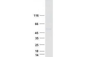 Western Blotting (WB) image for Tripartite Motif Containing 11 (TRIM11) protein (Myc-DYKDDDDK Tag) (ABIN2734223)