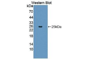 Western blot analysis of the recombinant protein. (2B4 Antikörper  (AA 26-212))