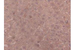 IHC-P analysis of Mouse Liver Tissue, with DAB staining. (alpha 2 Macroglobulin Antikörper  (AA 1053-1214))