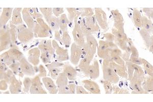 Detection of SHBG in Human Cardiac Muscle Tissue using Monoclonal Antibody to Sex Hormone Binding Globulin (SHBG) (SHBG Antikörper  (AA 224-388))