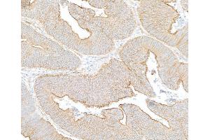 Immunohistochemistry (IHC) image for anti-Spectrin Beta, Non-Erythrocytic 1 (SPTBN1) (AA 2100-2150) antibody (ABIN7454694) (SPTBN1 Antikörper  (AA 2100-2150))
