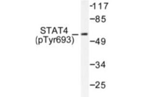 Image no. 1 for anti-Signal Transducer and Activator of Transcription 4 (STAT4) (pTyr693) antibody (ABIN318129) (STAT4 Antikörper  (pTyr693))