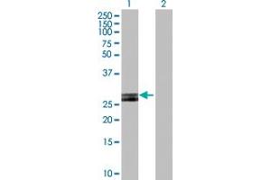 Western Blot analysis of HLA-DOB expression in transfected 293T cell line by HLA-DOB MaxPab polyclonal antibody. (HLA-DOB Antikörper  (AA 1-273))