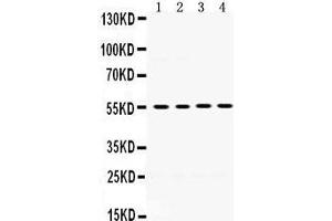 Western Blotting (WB) image for anti-Matrix Metallopeptidase 8 (Neutrophil Collagenase) (MMP8) (AA 120-157), (N-Term) antibody (ABIN3043883) (MMP8 Antikörper  (N-Term))