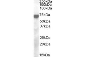 Western Blotting (WB) image for anti-Potassium Voltage-Gated Channel, KQT-Like Subfamily, Member 4 (KCNQ4) (Internal Region) antibody (ABIN2466703) (KCNQ4 Antikörper  (Internal Region))