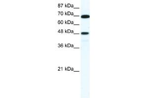 WB Suggested Anti-ZNF446 Antibody Titration:  5. (ZNF446 Antikörper  (N-Term))