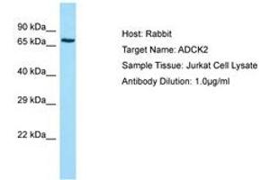 Image no. 1 for anti-AarF Domain Containing Kinase 2 (ADCK2) (AA 257-306) antibody (ABIN6749962) (ADCK2 Antikörper  (AA 257-306))