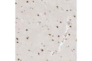 Immunohistochemical staining of human cerebral cortex with NHSL1 polyclonal antibody  shows strong nuclear positivity in neuronal cells at 1:200-1:500 dilution. (NHSL1 Antikörper)