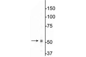 Western Blotting (WB) image for anti-gamma-aminobutyric Acid (GABA) A Receptor, Subunit beta 1 (GABRB1) (Cytoplasmic Loop) antibody (ABIN6254106)