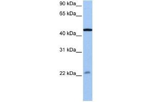 EWSR1 antibody used at 0.