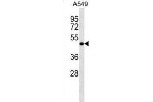 Western Blotting (WB) image for anti-Leucine Rich Repeat Containing 26 (LRRC26) antibody (ABIN2998660) (LRRC26 Antikörper)