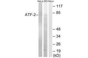 Western blot analysis of extracts from HeLa cells and 293 cells, using ATF-2 (Ab-472) antibody. (ATF2 Antikörper  (Ser472))