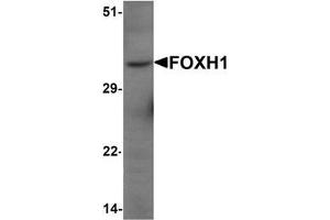 Western blot analysis of FOXH1 in human liver tissue lysate with FOXH1 Antibody  at 1 μg/mL (FOXH1 Antikörper  (N-Term))