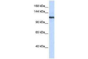 Western Blot showing PLA2G4B antibody used at a concentration of 1-2 ug/ml to detect its target protein. (PLA2G4B Antikörper  (N-Term))