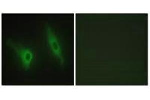 Immunofluorescence analysis of HeLa cells, using CKI-ε antibody. (CK1 epsilon Antikörper)