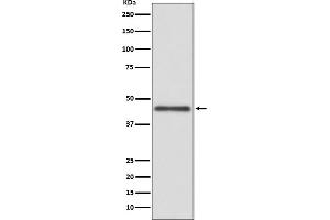 Western blot analysis of HLA G expression in Jurkat cell lysate.