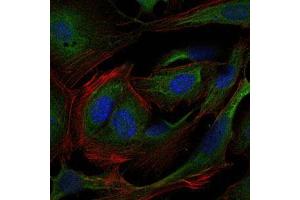 Immunofluorescence analysis of 3T3-L1 cells using CRK mouse mAb (green). (Crk Antikörper)