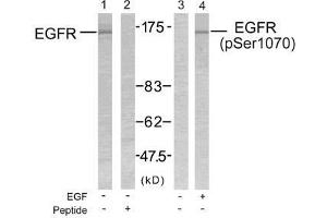 Western blot analysis of extract from SK-OV3 cells untreated or treated with EGF using EGFR (Ab-1070) antibody (E021073, Lane 1 and 2) and EGFR (phospho-Ser1070) antibody (E011080, Lane 3 and 4). (EGFR Antikörper)