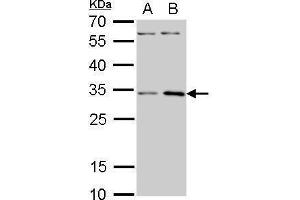 Western Blotting (WB) image for anti-Ribosomal Protein S3A (RPS3A) antibody (ABIN2856016)