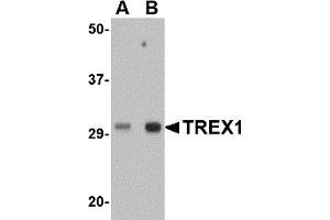 Western Blotting (WB) image for anti-three Prime Repair Exonuclease 1 (TREX1) (Middle Region) antibody (ABIN1031144) (TREX1 Antikörper  (Middle Region))