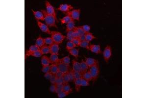 IF analysis of QPRT using anti-QPRT antibody (ABIN7600821).