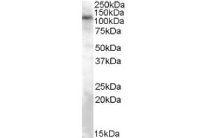 Image no. 1 for anti-Transient Receptor Potential Cation Channel, Subfamily C, Member 4 (TRPC4) (Internal Region) antibody (ABIN375258)
