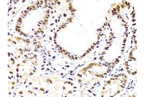 Immunohistochemistry of paraffin-embedded human stomach using PCNA antibody (ABIN1874056) at dilution of 1:100 (40x lens). (PCNA Antikörper)