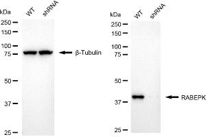 Western blotting analysis using RABEPK antibody (ABIN7800108). (Rekombinanter RABEPK Antikörper)