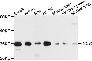 Western blot analysis of extracts of various cell lines, using CD53 antibody. (CD53 Antikörper)