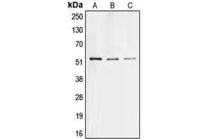 Western blot analysis of Collagen 26 alpha 1 expression in Hela (A), PC12 (B), H9C2 (C) whole cell lysates. (Collagen, Type XXVI, alpha 1 (COL26A1) (Center) Antikörper)