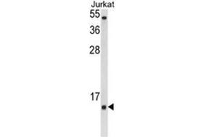 Western blot analysis of SOD1 Antibody (Center) in Jurkat cell line lysates (35ug/lane). (SOD1 Antikörper  (Middle Region))