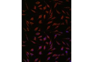 Immunofluorescence analysis of L929 cells using NXT2 antibody (ABIN6133260, ABIN6144977, ABIN6144978 and ABIN6217951) at dilution of 1:100. (NXT2 Antikörper  (AA 110-180))