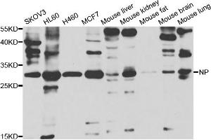 Western blot analysis of extracts of various cell lines, using PNP antibody (ABIN5973400) at 1/1000 dilution. (PNP Antikörper)