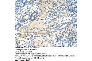 Immunohistochemistry (IHC) image for anti-SWI/SNF Related, Matrix Associated, Actin Dependent Regulator of Chromatin, Subfamily E, Member 1 (SMARCE1) (N-Term) antibody (ABIN2780465)