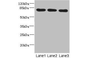 Western blot All lanes: BBS2 antibody at 5. (BBS2 Antikörper  (AA 1-96))
