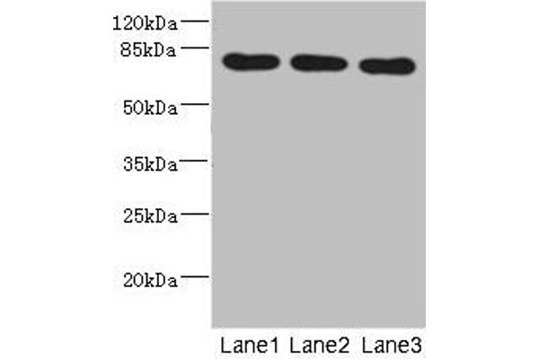 BBS2 Antikörper  (AA 1-96)