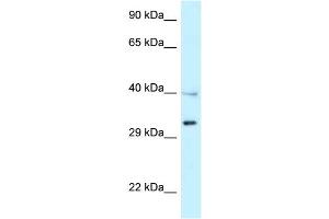 WB Suggested Anti-TNFRSF14 Antibody Titration: 1. (HVEM Antikörper  (Middle Region))