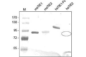 Western analysis of recombinant Human and Mouse sTIE-1 and sTIE-2 using a Polyclonal antibody directed against Mouse recombinant sTIE-1. (TIE1 Antikörper  (AA 22-748))