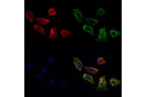 ABIN7093960 and ABIN7098004 staining Hela cells by IF/ICC. (PPP3CB Antikörper  (C-Term))