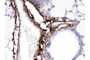 Collagen I was detected in paraffin-embedded sections of mouse lung tissues using rabbit anti- Collagen I Antigen Affinity purified polyclonal antibody (Catalog # ) at 1 µg/mL. (COL1A1 Antikörper  (C-Term))