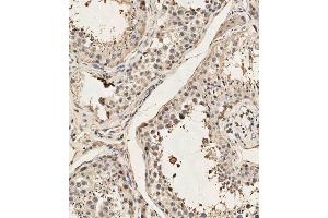 (ABIN657991 and ABIN2846937) staining Dyrk2 in human testis tissue sections by Immunohistochemistry (IHC-P - paraformaldehyde-fixed, paraffin-embedded sections). (DYRK2 Antikörper  (C-Term))