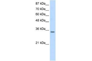 SNRPA antibody used at 0. (SNRPA1 Antikörper  (Middle Region))