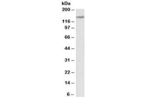 Western blot testing of human cerebellum lysate with LMTK2 antibody at 2ug/ml. (LMTK2 Antikörper)