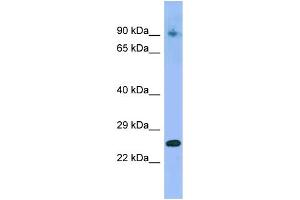 WB Suggested Anti-IFNA4 Antibody Titration: 1. (IFNA4 Antikörper  (C-Term))
