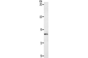Gel: 8 % SDS-PAGE, Lysate: 40 μg, Lane: Human fetal liver tissue, Primary antibody: ABIN7128148(ACAD11 Antibody) at dilution 1/400, Secondary antibody: Goat anti rabbit IgG at 1/8000 dilution, Exposure time: 1 minute (ACAD11 Antikörper)