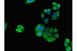 Immunofluorescent analysis of HepG2 cells using ABIN7142516 at dilution of 1:100 and Alexa Fluor 488-congugated AffiniPure Goat Anti-Rabbit IgG(H+L)